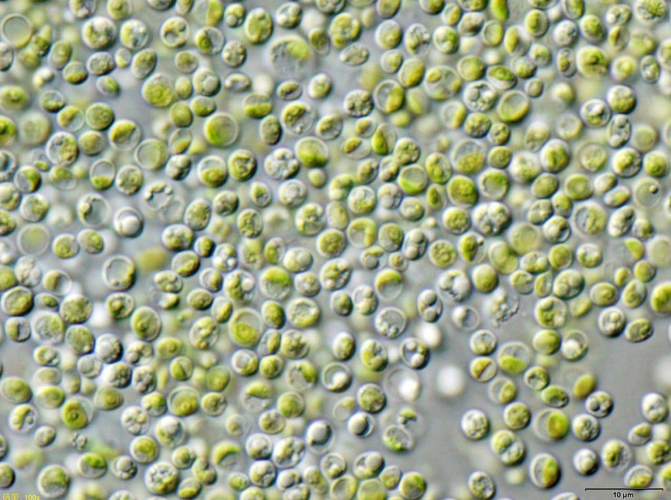 Chlorella vulgaris